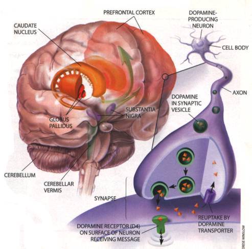 ADHD to Focus