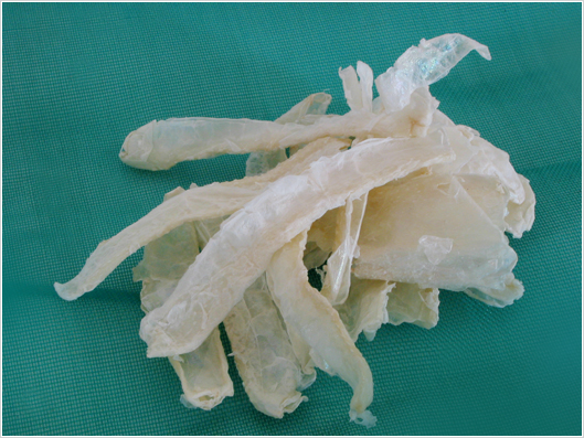 Chitosan