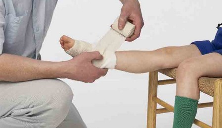 Sprained Ankle