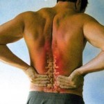 How to Treat Back Pain 
