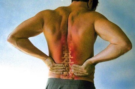 Back Pain