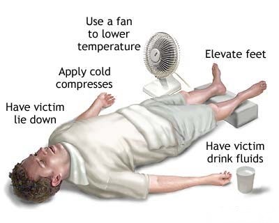 How to Treat Heat Exhaustion and Heatstroke  Heatstroke