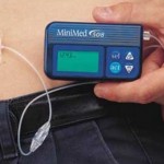 How to Use Insulin Infusion Pump for Diabetes 