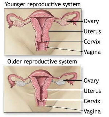 Menopause