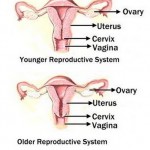 How to Treat Menopause 
