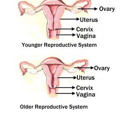 Menopause