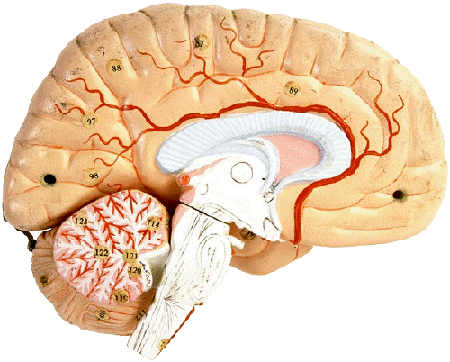 Parkinson's disease