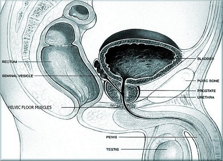 Prostate Disease