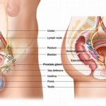 How to Treat Prostate Disease 