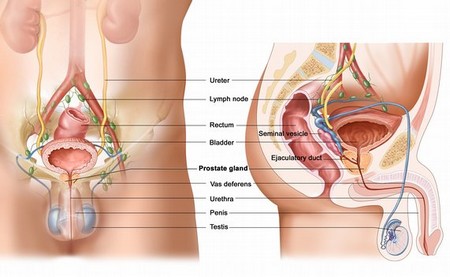 Prostate Disease