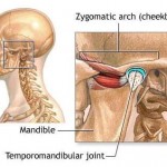 How to Treat Temporomandibular Joint Syndrome (TMJ) 