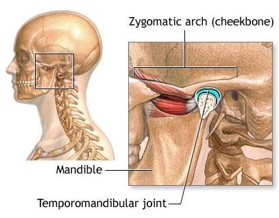 Temporomandibular Joint Syndrome