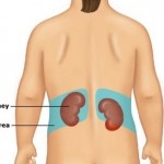 How to Treat Back Pain in Children 