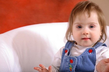 newborns with down syndrome. Down#39;s syndrome is present in