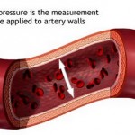 How to Deal with High Cholesterol 