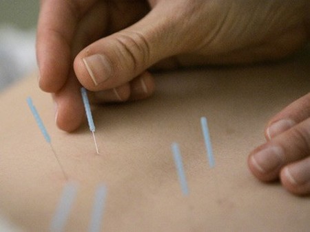 How to Treat Cellulitis with Acupuncture Treat Cellulitis Acupuncture