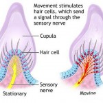 How to Treat Vertigo