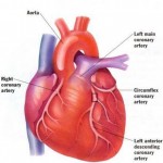 How to Deal with Pain and Discomfort in Heart Disease