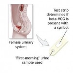 How to Manage Asthma Through Pregnancy