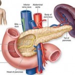 How to Treat Diabetes