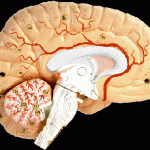 How to Deal with Parkinson's Disease