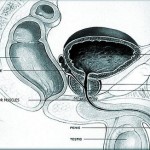How to Reduce Your Risk of Prostate Disease