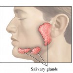 How to Treat Sjogren's Syndrome