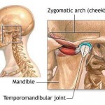 How to Treat Temporomandibular Joint Syndrome (TMJ)