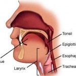 How to Treat Laryngitis in Children