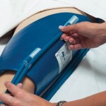 How to Treat Hypothermia Effectively