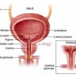 How to Understand Incontinence