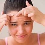 How to Prevent the Occurrence of Acne