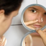 How to Stop Acne During Stressful Times