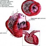 How to Get rid of a Dog's Heartworm
