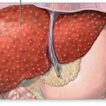 How to Cure Liver Diseases in Dogs