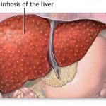 How to Treat Liver Disease in Dogs