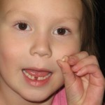 How to Pull a Loose Tooth