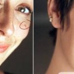 How to Remove Facial Blemishes in Photoshop