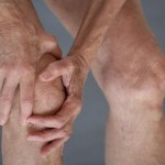 How to Recognize the Signs of Arthritis