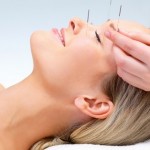 How to Reduce Nausea through Acupuncture