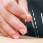 How to Perform Self-Acupuncture