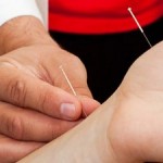 How to Stop Smoking with Acupuncture