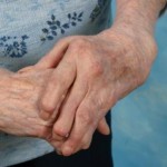 How to Manage Some Forms of Arthritis