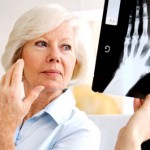 How to Live with Rheumatoid Arthritis for Life